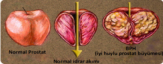 normal_idrar_akimi