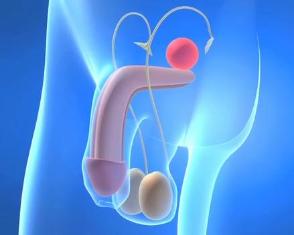 Penis Eğriliği