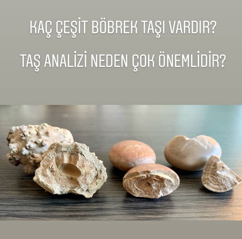 Böbrek Taş Hastalıkları